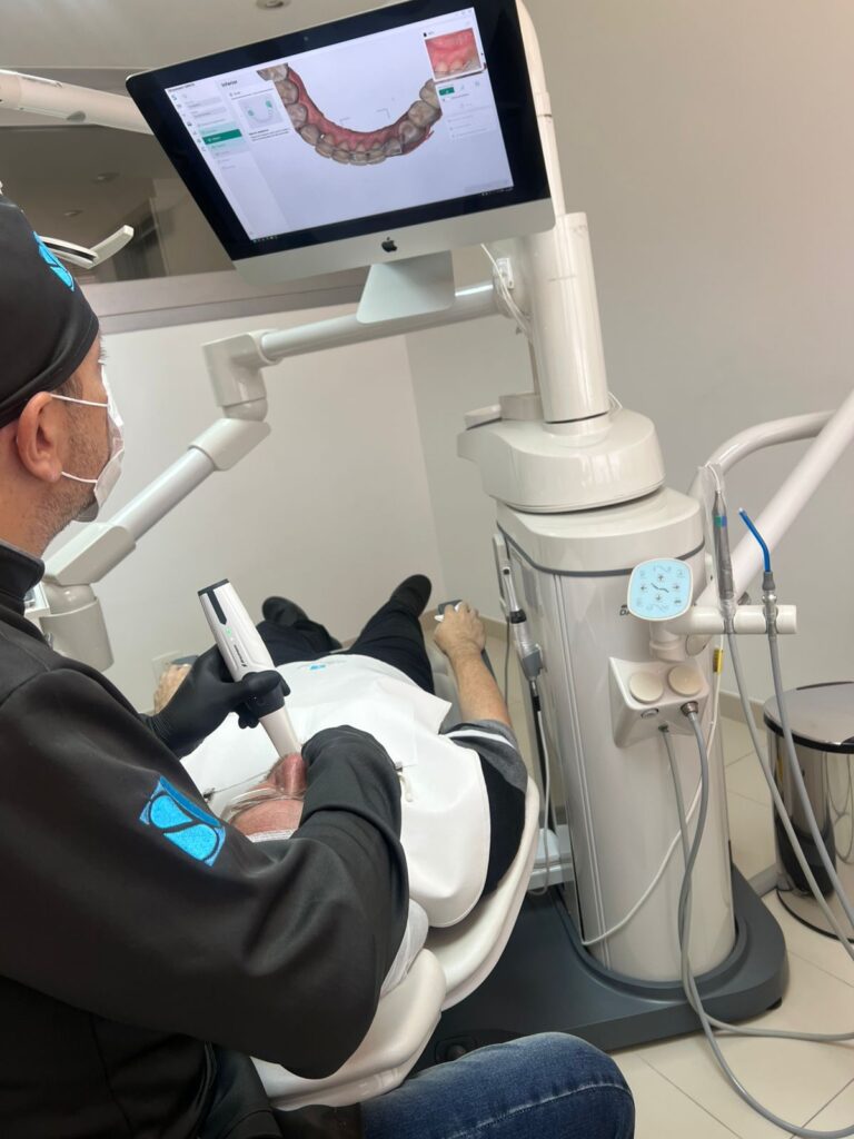 Moldagem digital na odontologia: como a tecnologia transforma o atendimento
