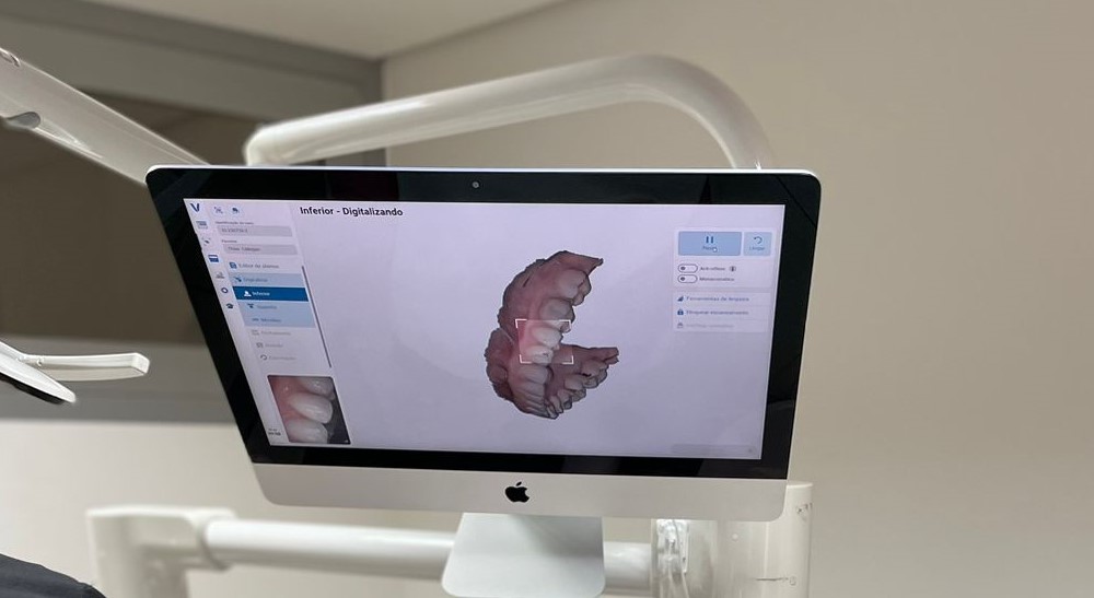 Odontologia digital: uma tecnologia que veio para ficar