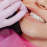 Mobilidade dental: você já ouviu falar?